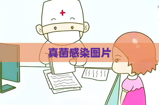 真菌感染图片