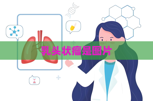 乳头状瘤是图片