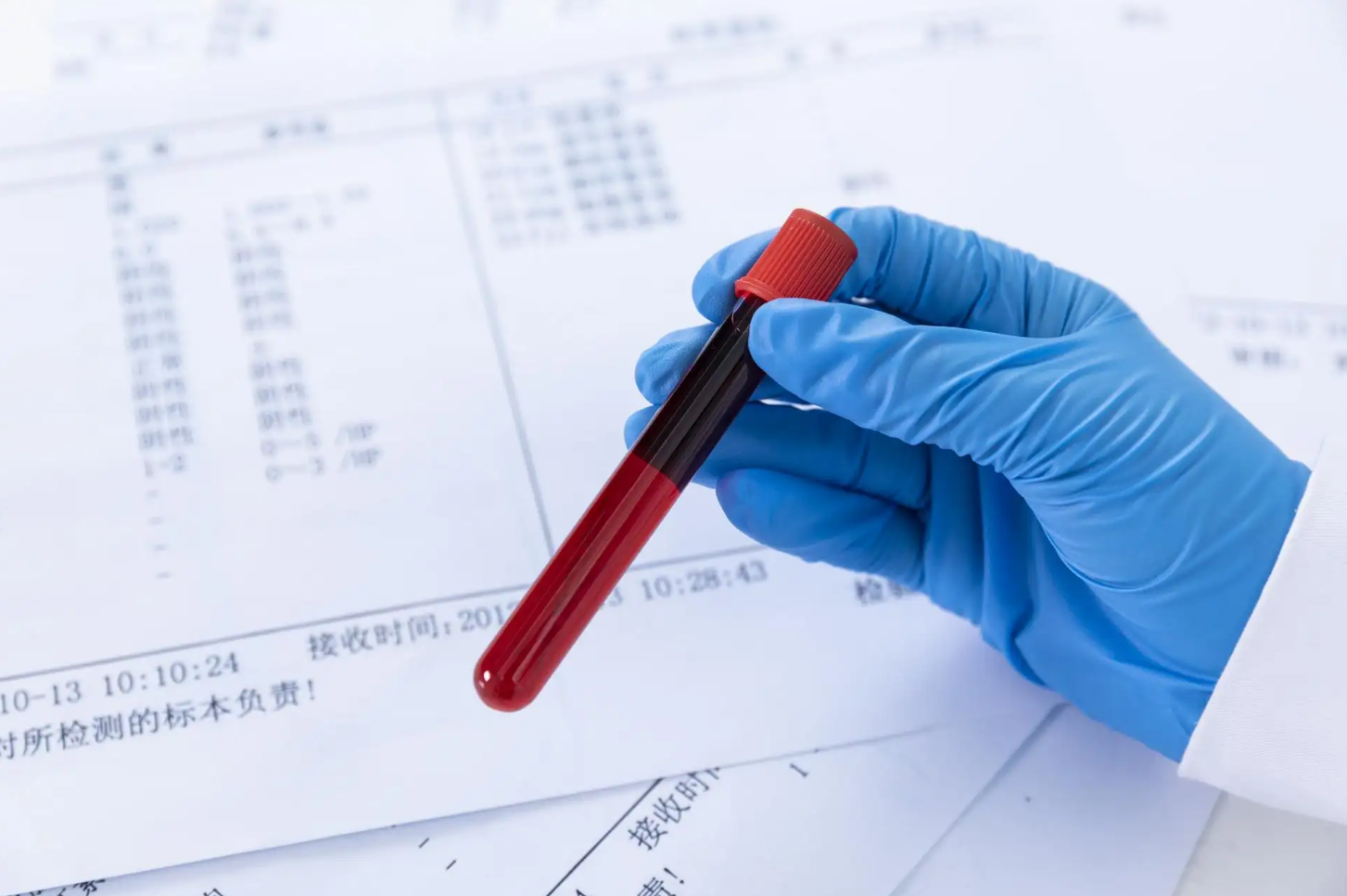 入职体检血糖高怎么办？具体血糖标准解析
